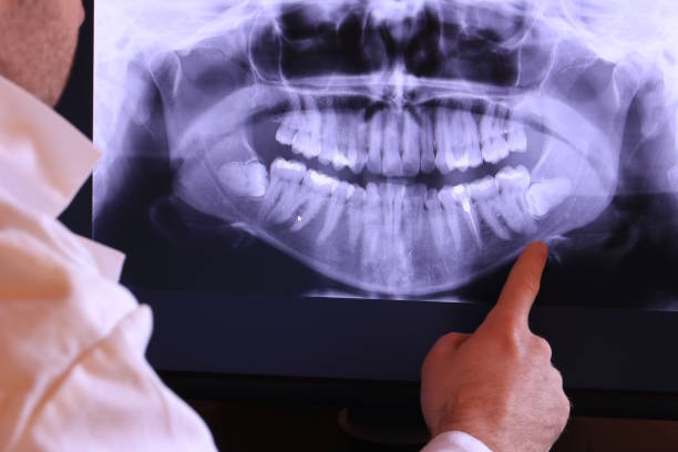 Best Cracked Tooth Emergency Dentist  in San Martin, CA