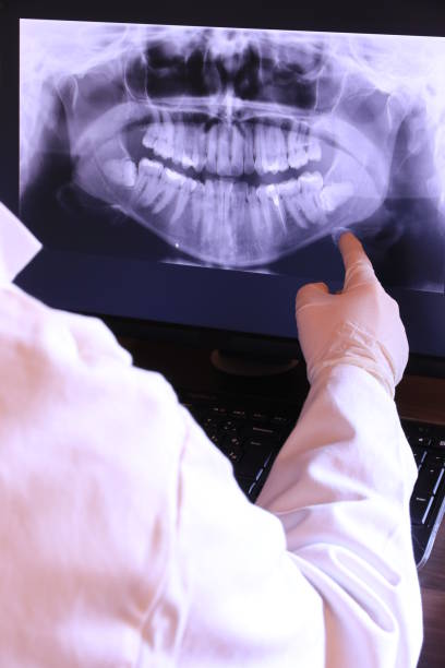 Best Knocked-Out Tooth Emergency  in San Martin, CA