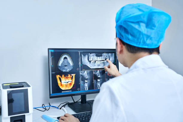 Best Chipped Tooth Repair Near Me  in San Martin, CA